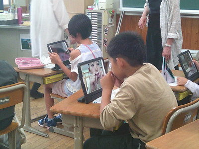 歯茎